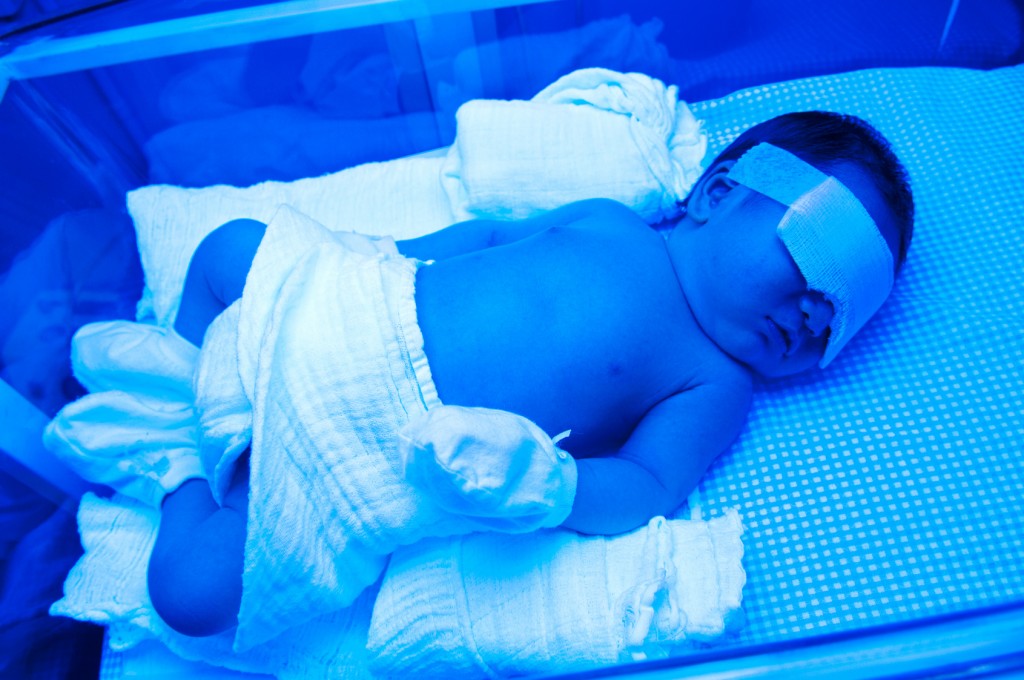 guest post, jaundice article