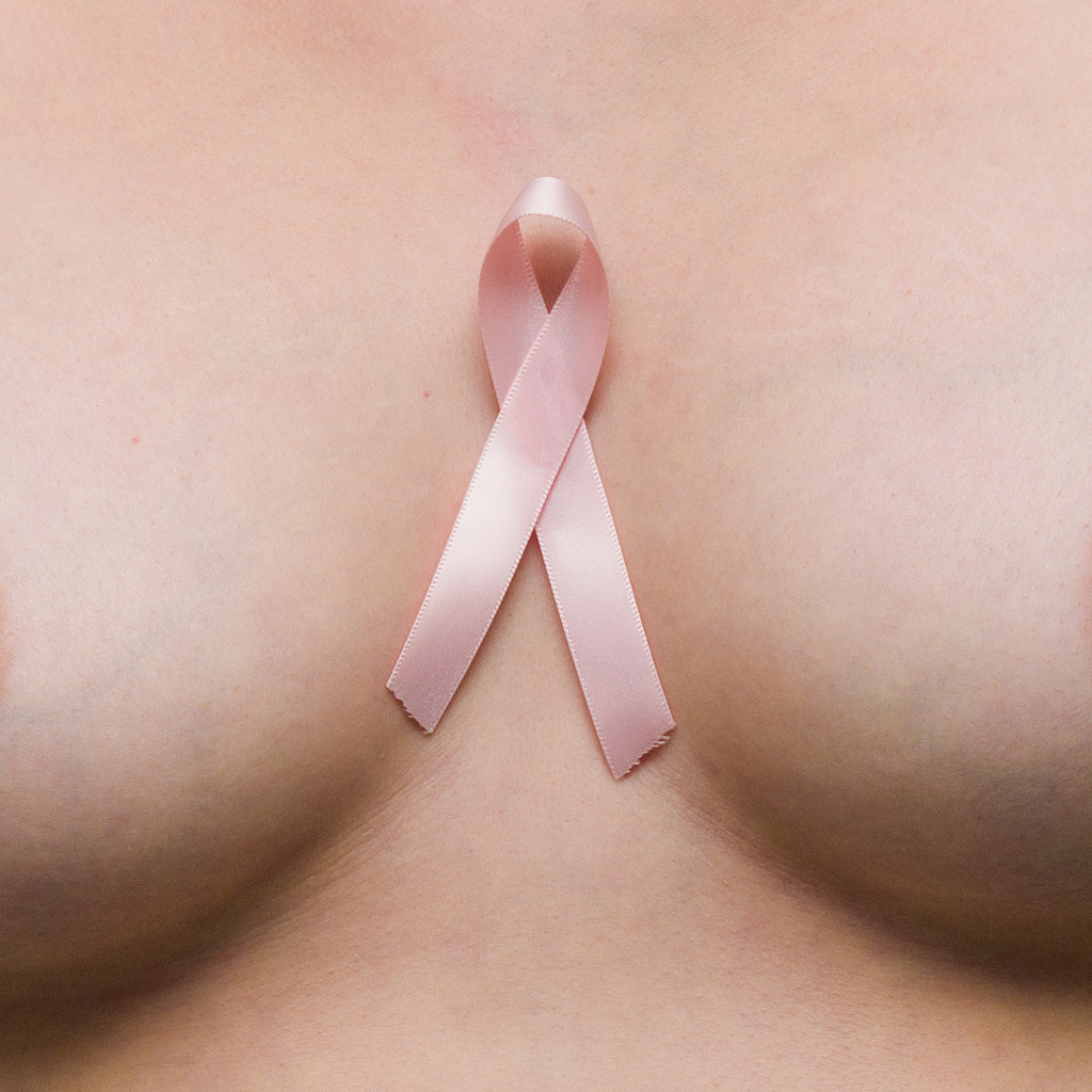 Breast Cancer, Because Reduced Risk Does Not Mean No Risk