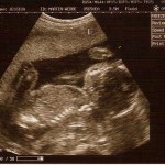 Boobs- Function and Pleasure