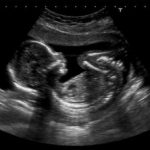 TLB Comic: Fur Babies Need Love Too